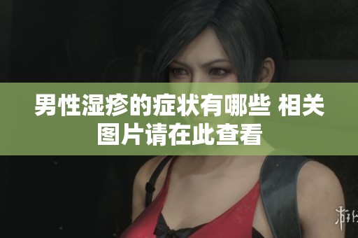 男性湿疹的症状有哪些 相关图片请在此查看